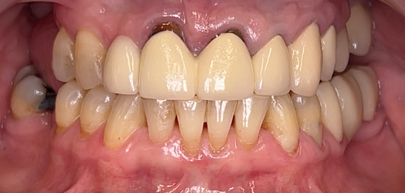 Before Image
