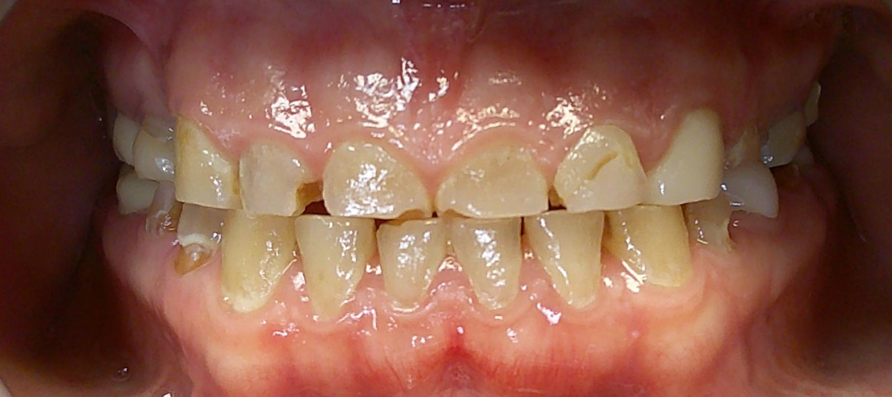 Before Image