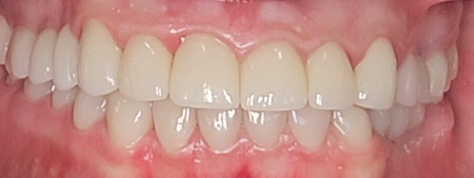 After Image