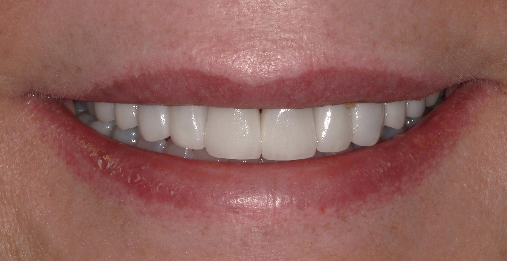 After Image