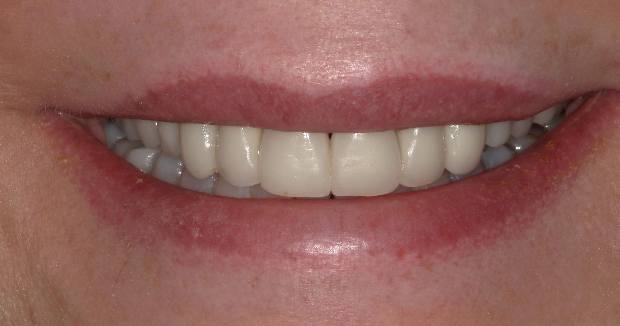 Before Image