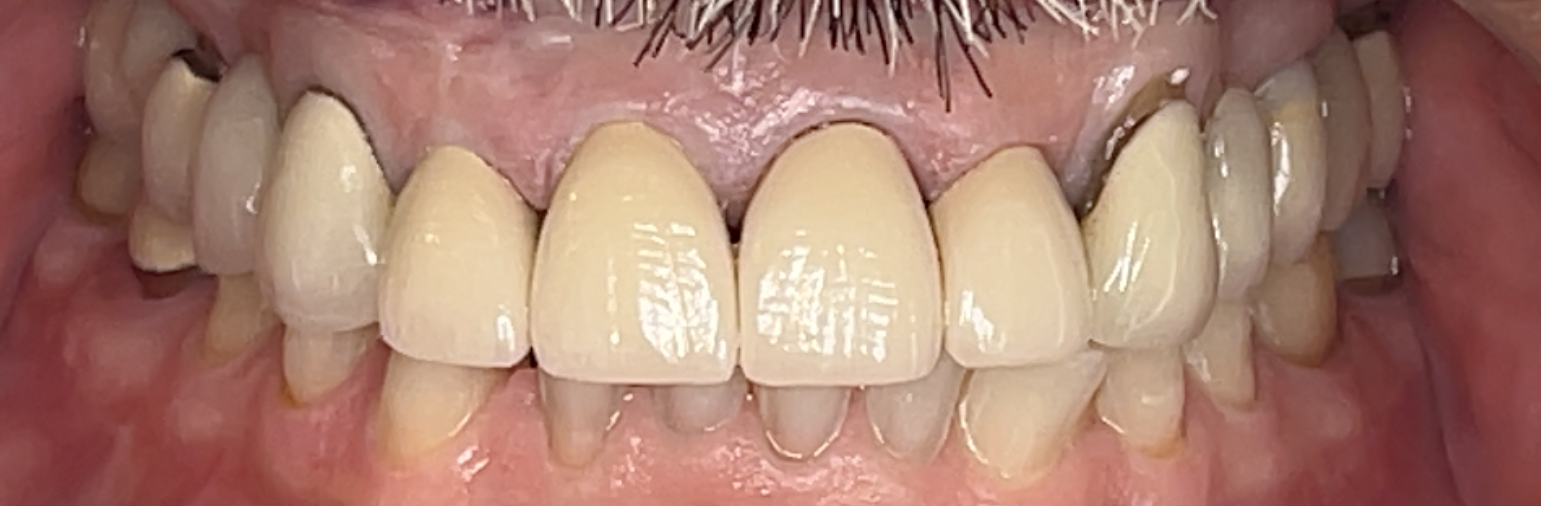 After Image