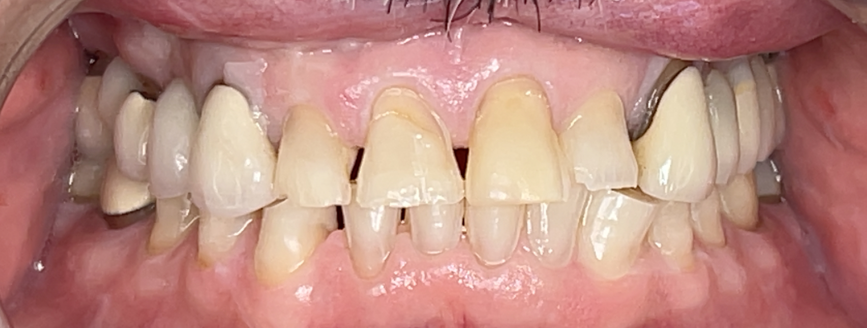 Before Image