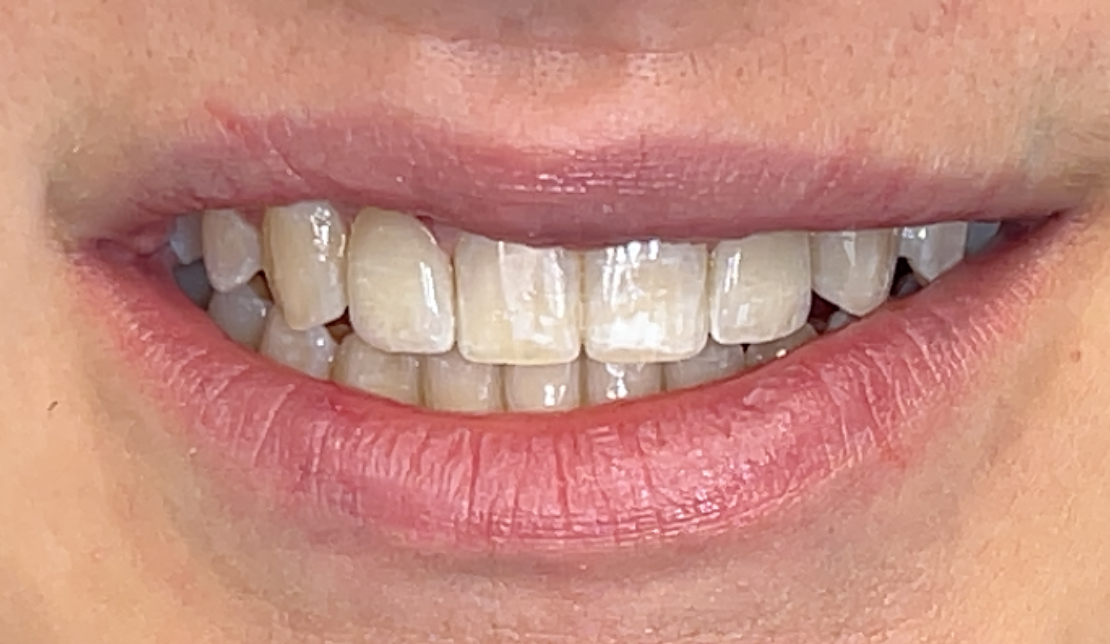 After Image
