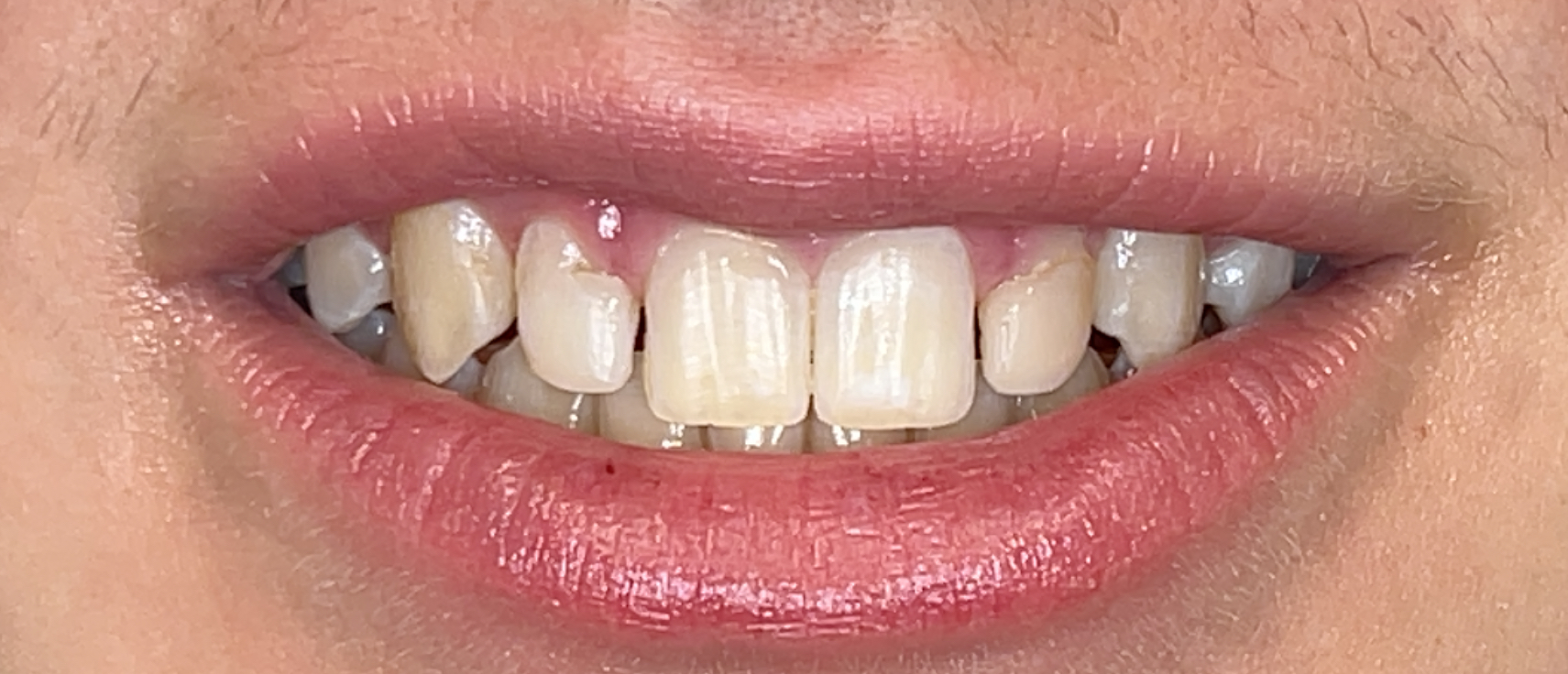 Before Image