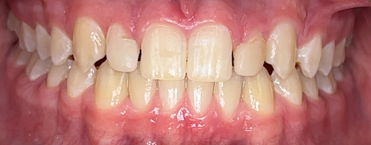 Before Image