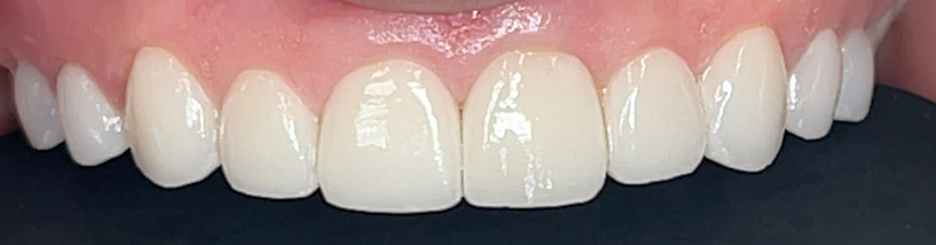 After Image