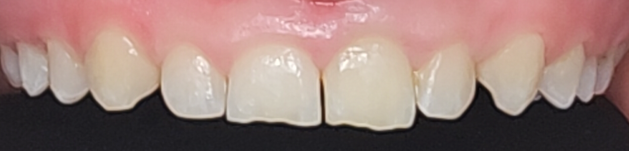 Before Image