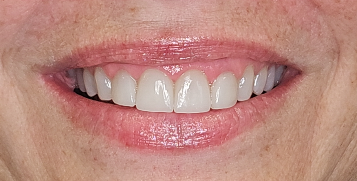 After Image