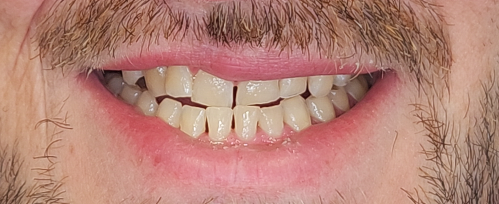 Before Image