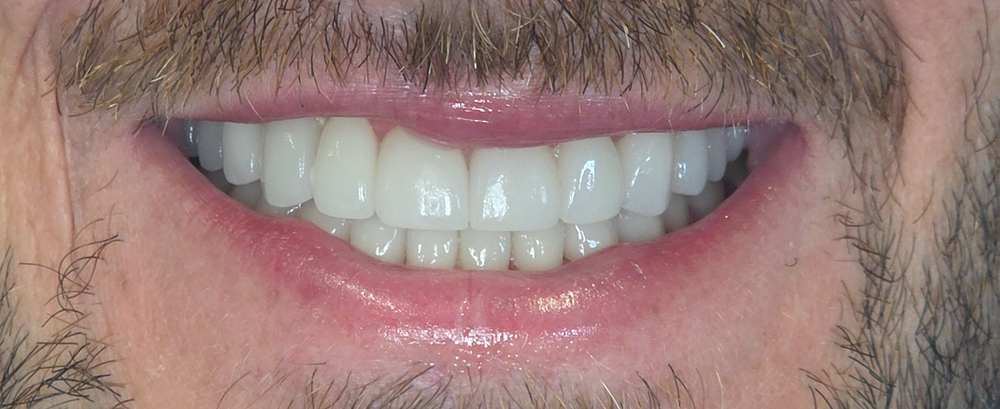 After Image