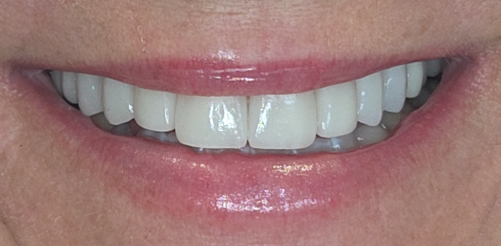 After Image
