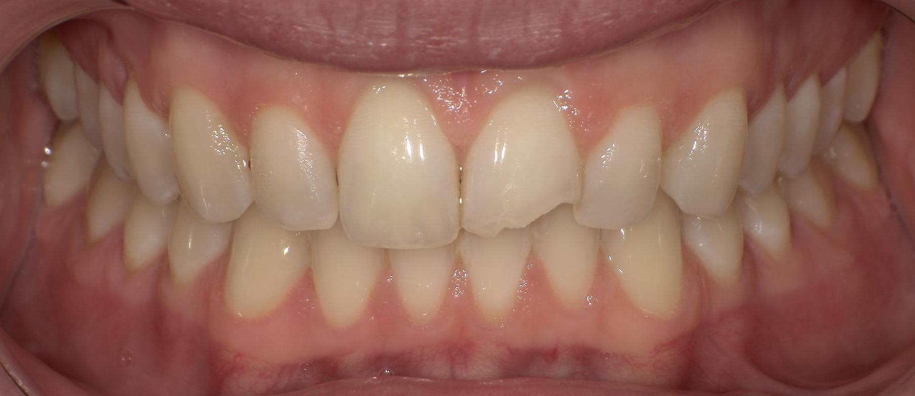 Before Image