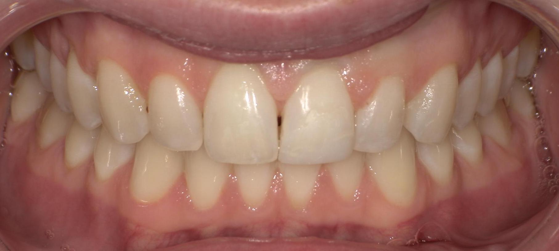 After Image