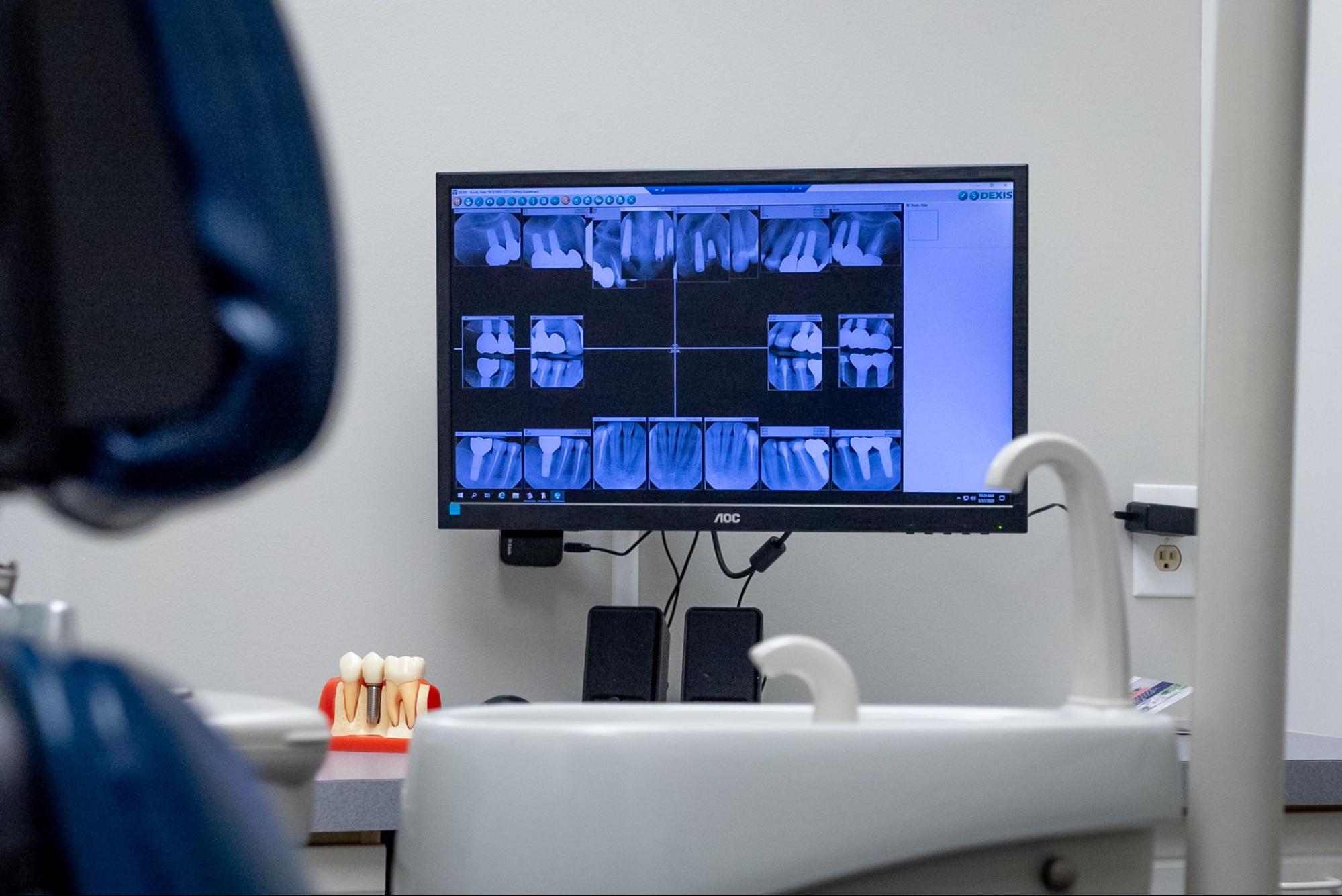 Your Child Says Their Teeth Feel Fine. So Why Do They Still Need a Dental Checkup?