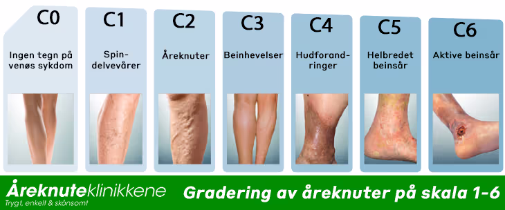 Er åreknuter farlige?