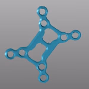 laser scanning 3d model of medical implant