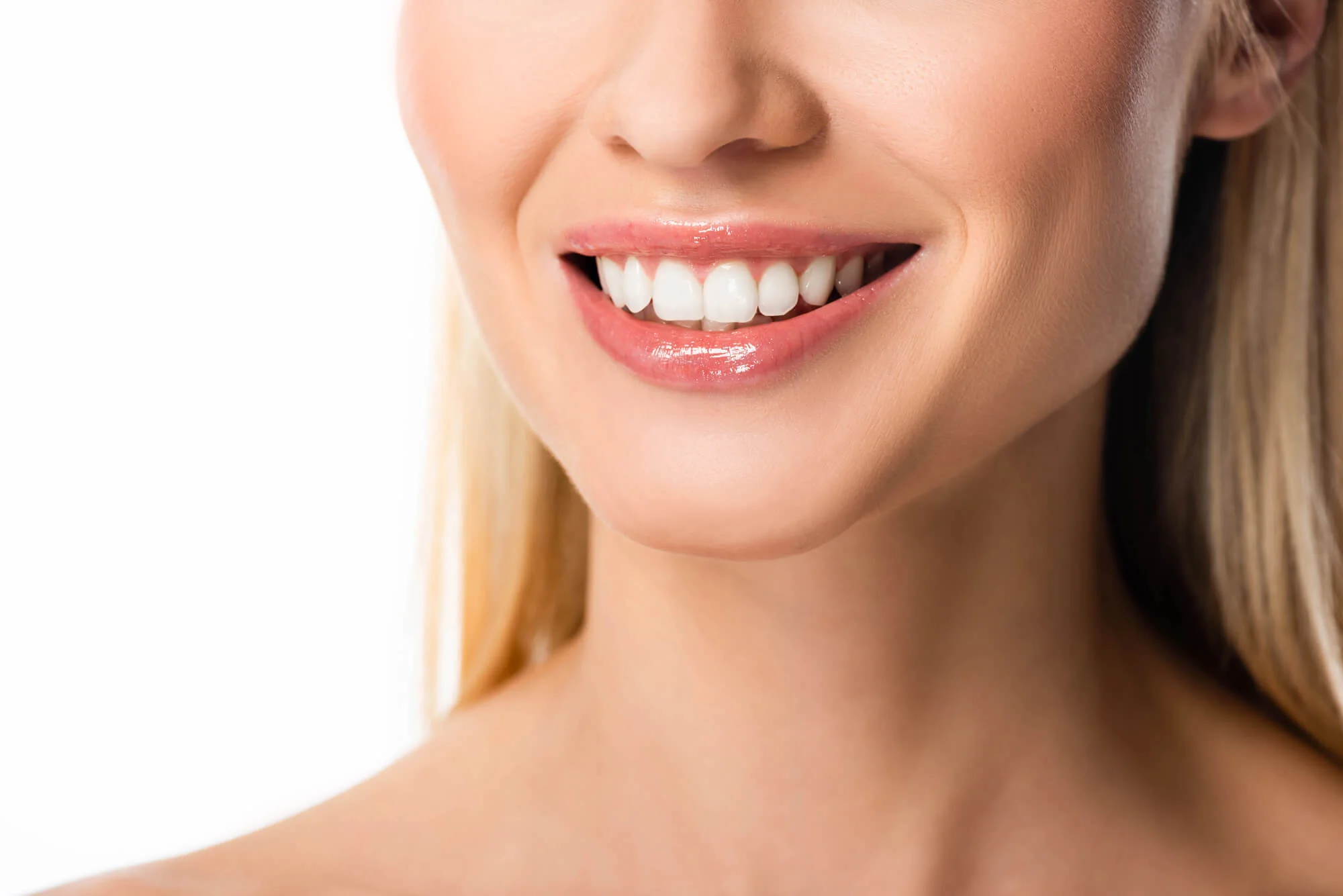 patient after Smile makeover in Birmingham 