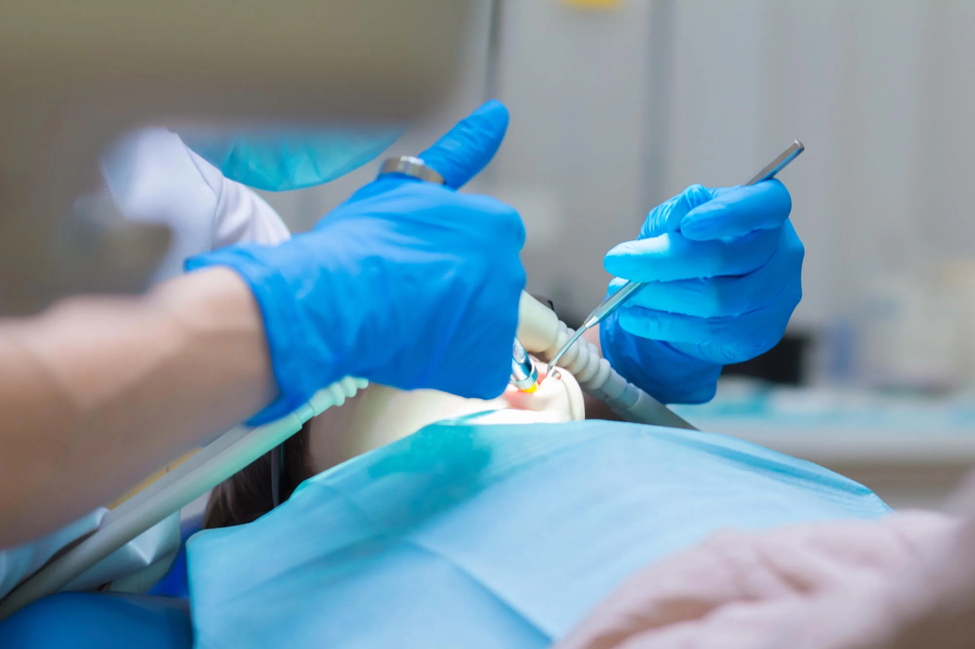 Dental treatment visit – dental implants in Birmingham, AL