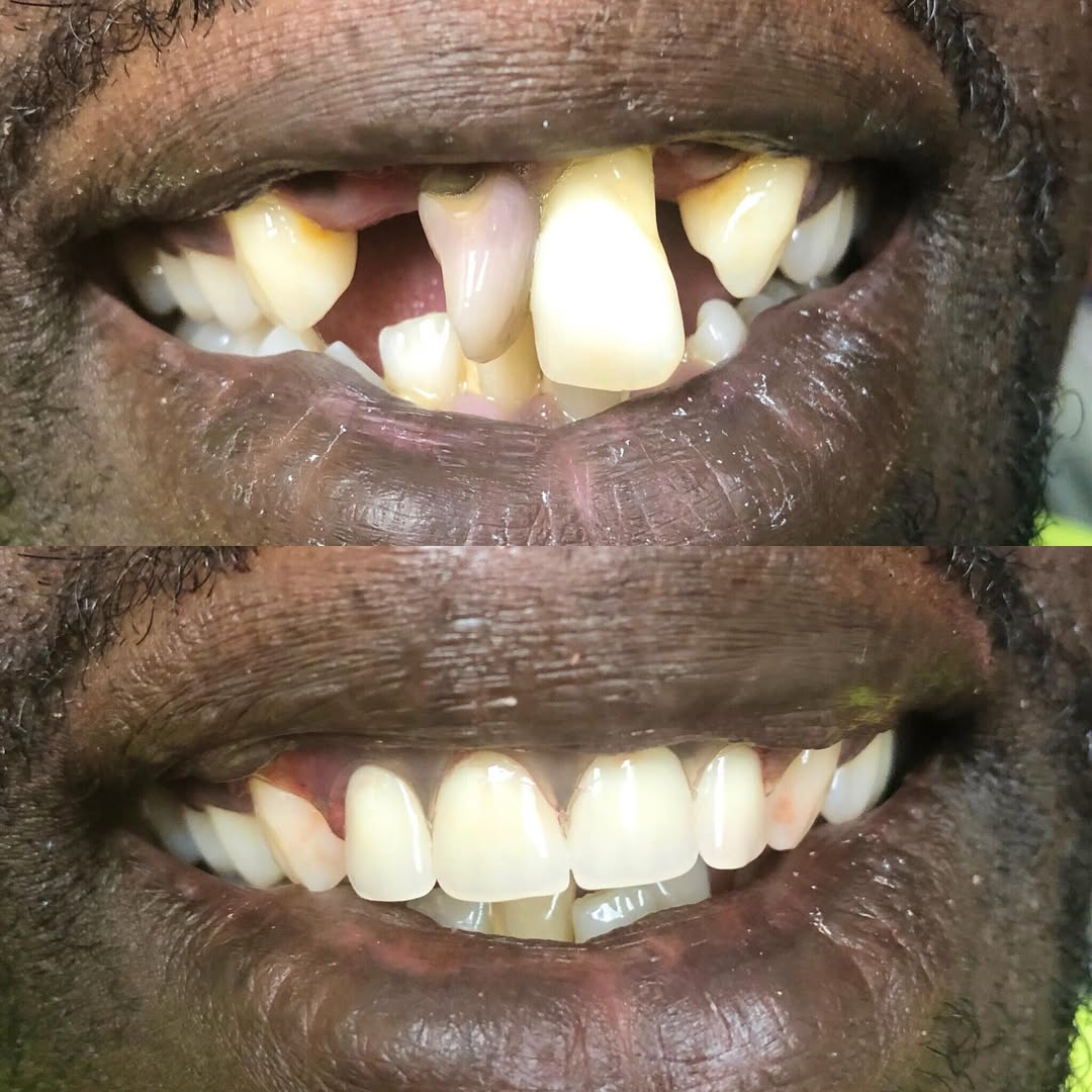 Dental care from a trusted general dentist near me in Northlake, Charlotte, NC.