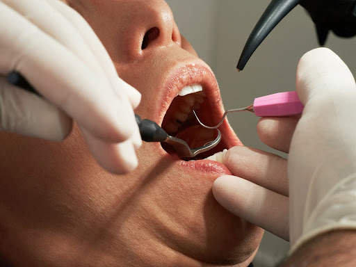 24-Hour Emergency Dentistry in Charlotte, NC offers quick relief and full treatment for oral pain or injury.