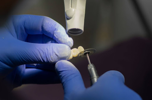 Crowns and bridges restore damaged or missing teeth for a balanced bite and complete smile