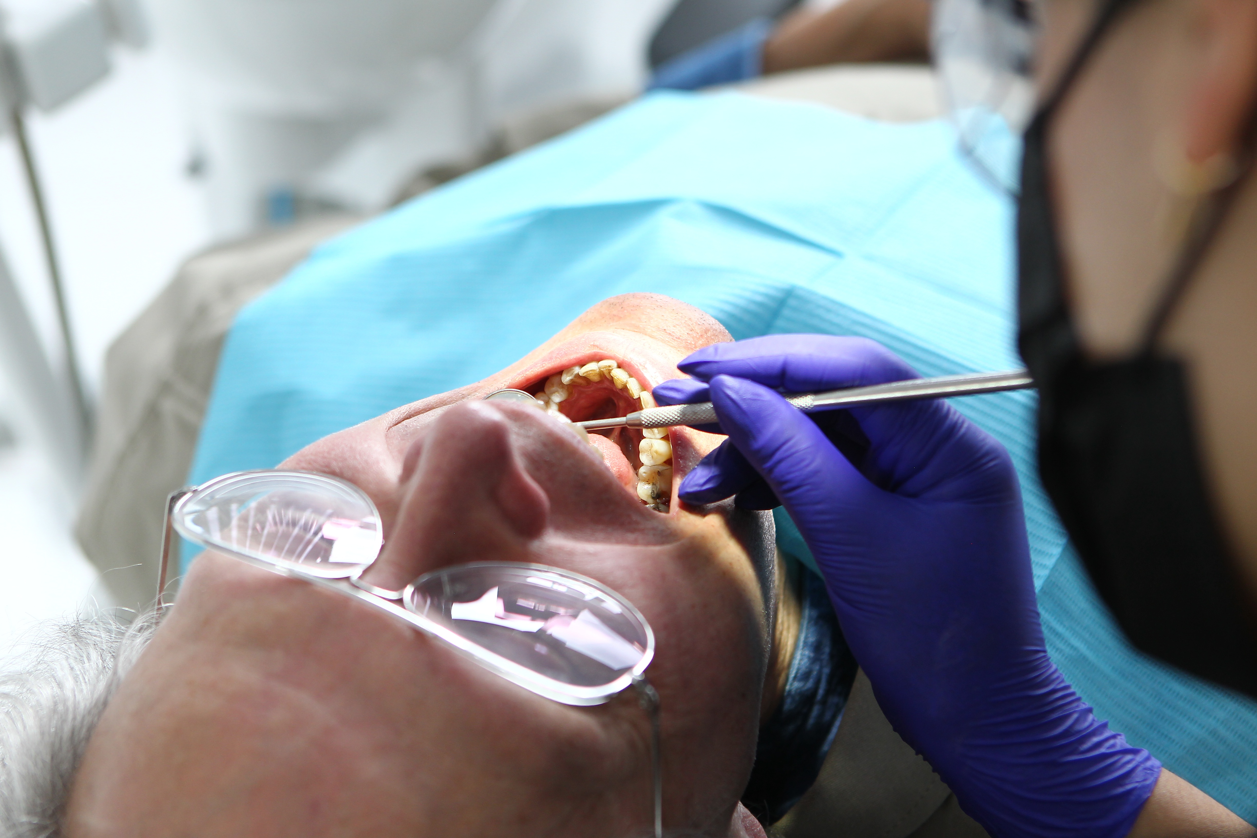 Dr. Rogers at the Next Level Dental Studio in Huntersville, NC, performs safe teeth whitening for sensitive teeth.
