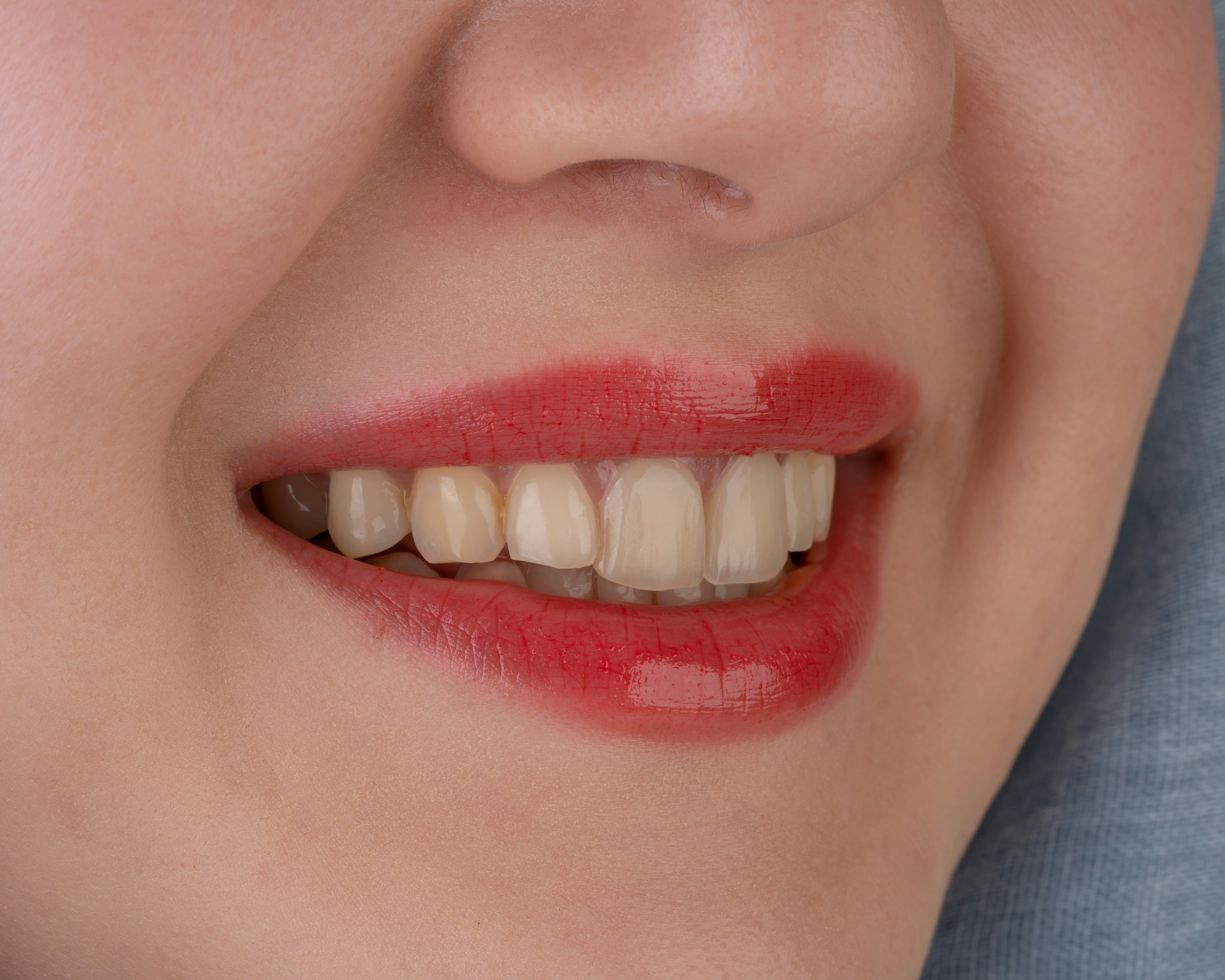 6 Natural Ways to Safely Try Teeth Whitening for Sensitive Teeth