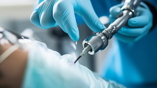 Scaling and root planing in Northlake, Charlotte, NC, are deep cleaning procedures to prevent gum disease.