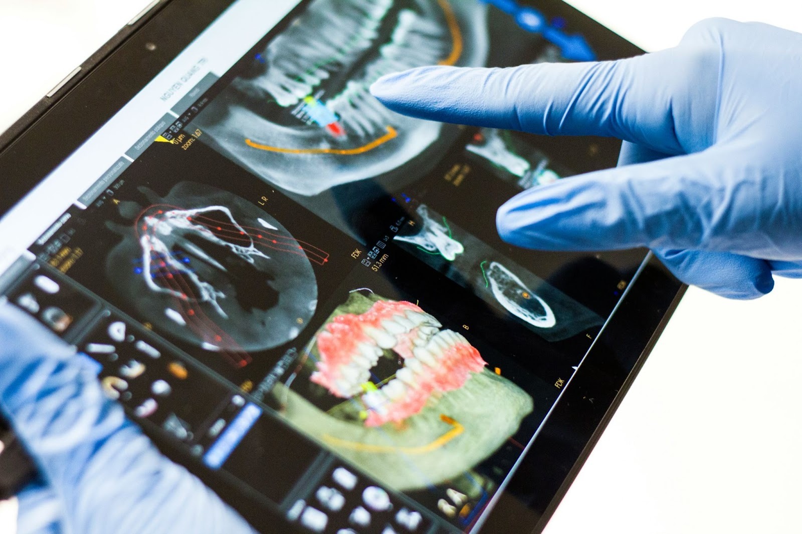 Dr Rogers is our dentist in Huntersville, NC, who can perform digital dental X-rays to detect oral issues early.