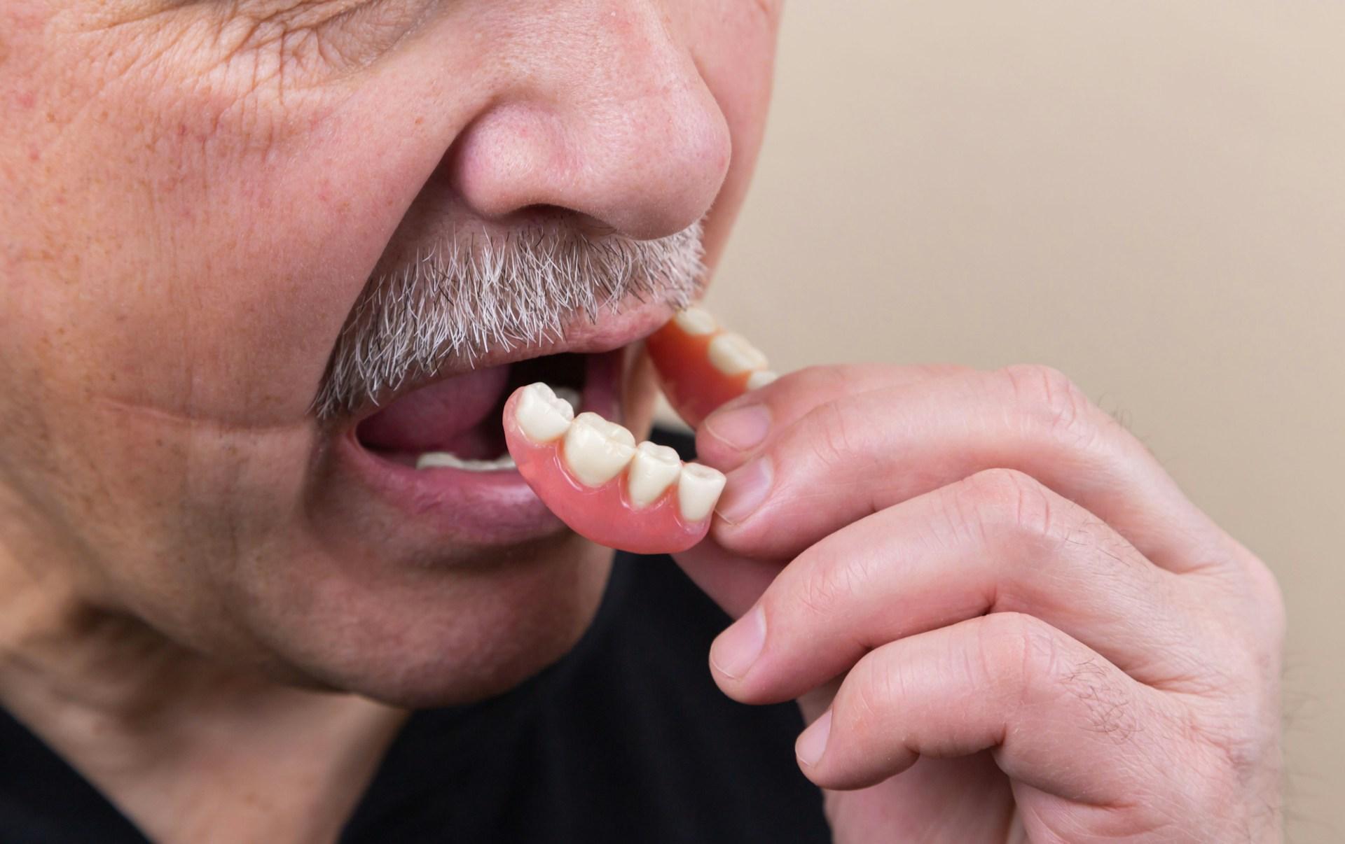 Dental Implants vs. Dentures: Which Tooth Replacement Option Is Right for You?