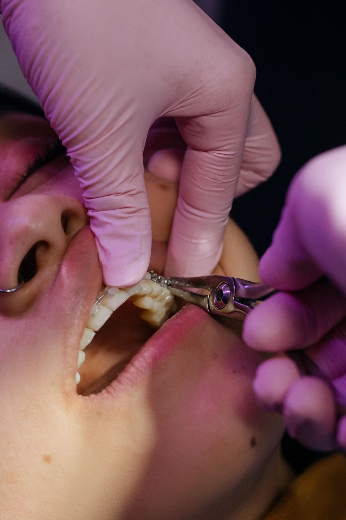 Dentist examining a patient's teeth at a dental practice