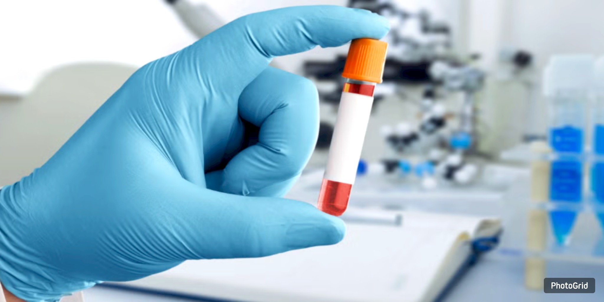 UTMB Galveston Signs Lab Services Agreement with Aspira Women’s Health  