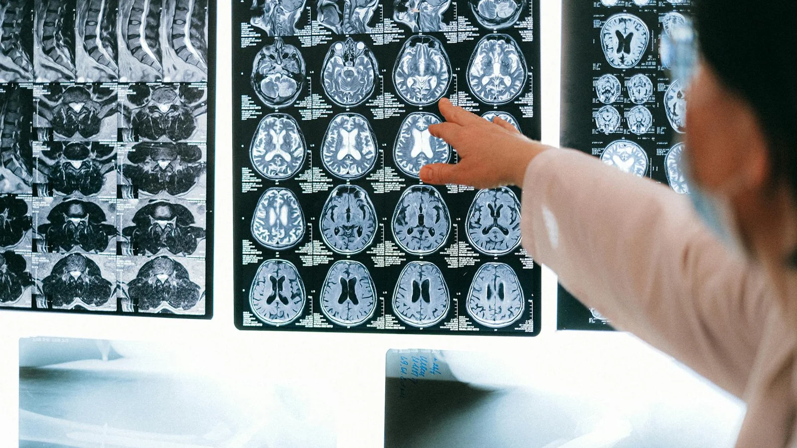 UTMB launches large-scale heart study to track aging and brain health