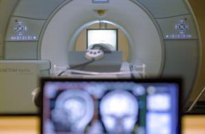 UTMB Chief Calls Brain Health a County-Wide Priority