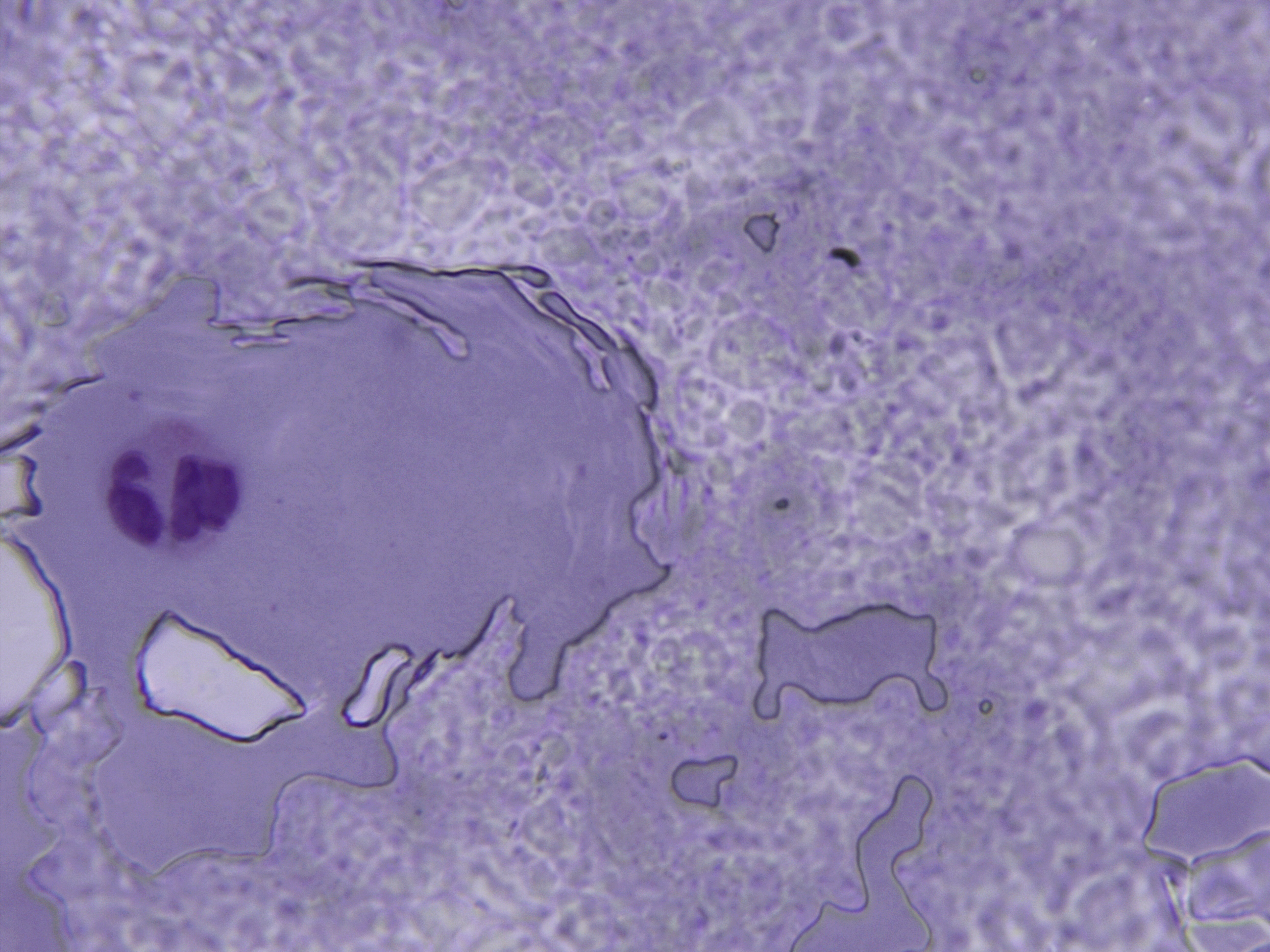 Blood (Giemsa stain)