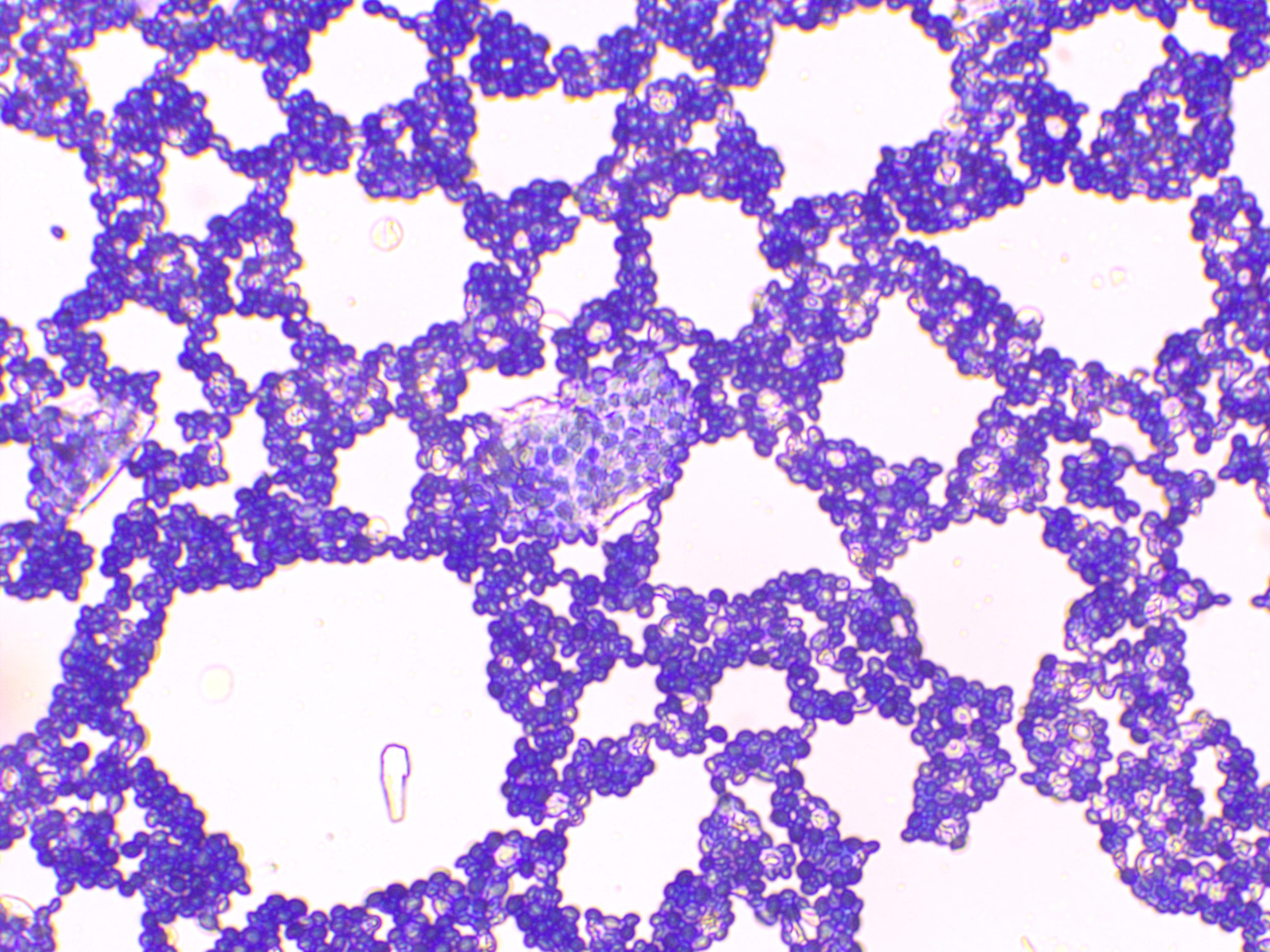 Stained yeast at 100x resolution.