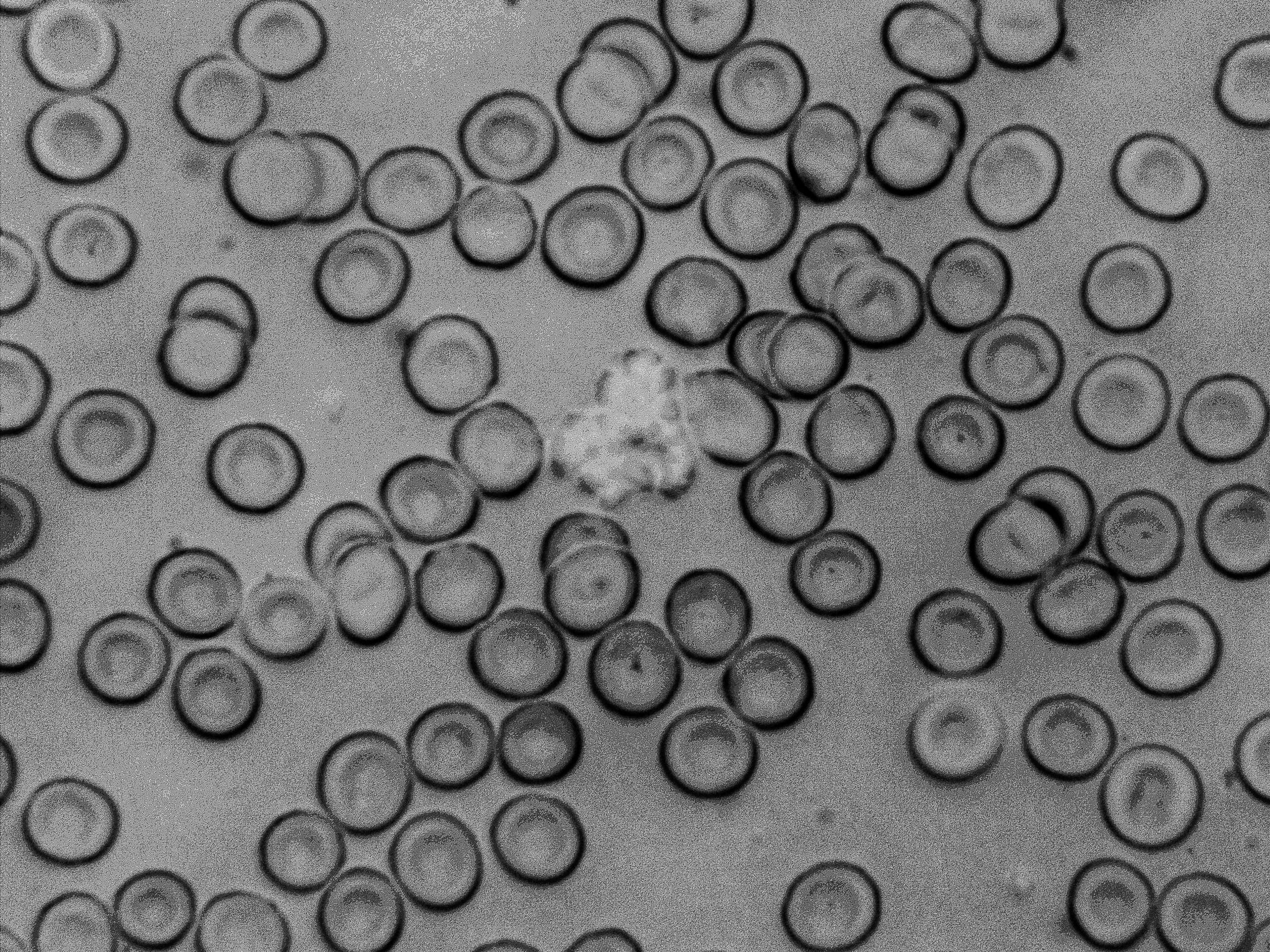 Blood cells.