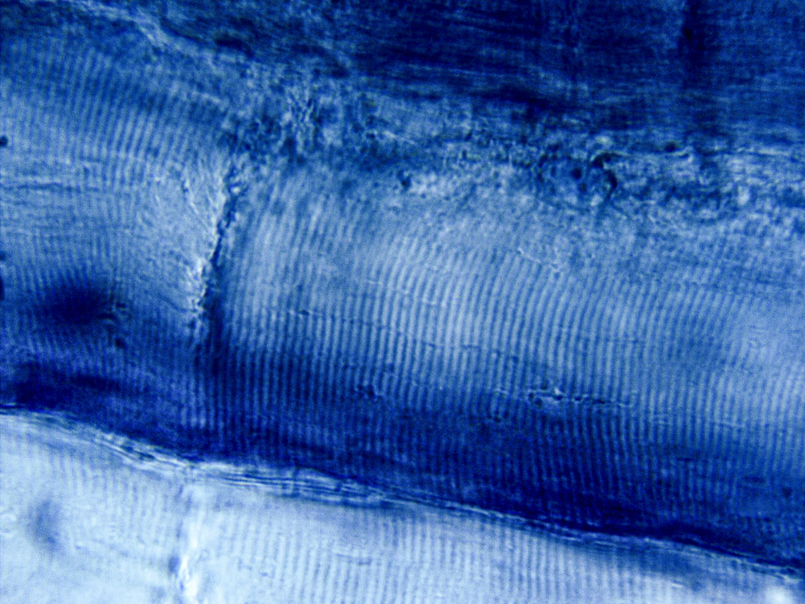 Muscle fiber cross-section (prepared from a cut of ham).