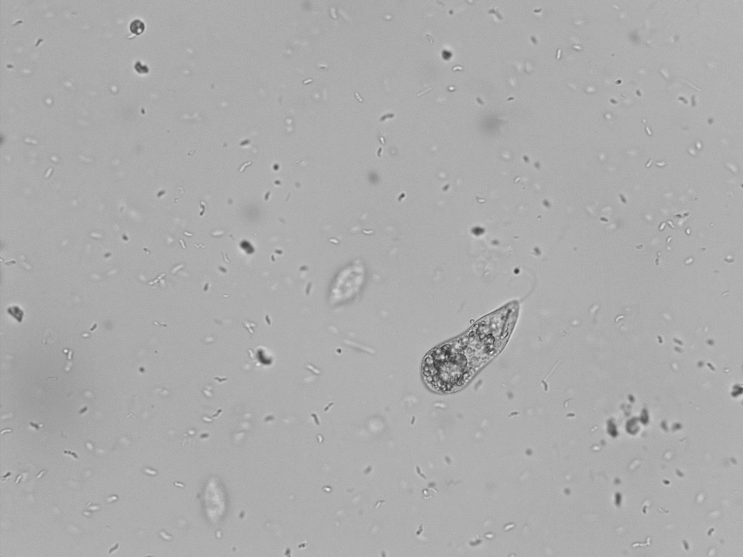 Euglena (a genus of single-celled eukaryotes), in diluted pond water.