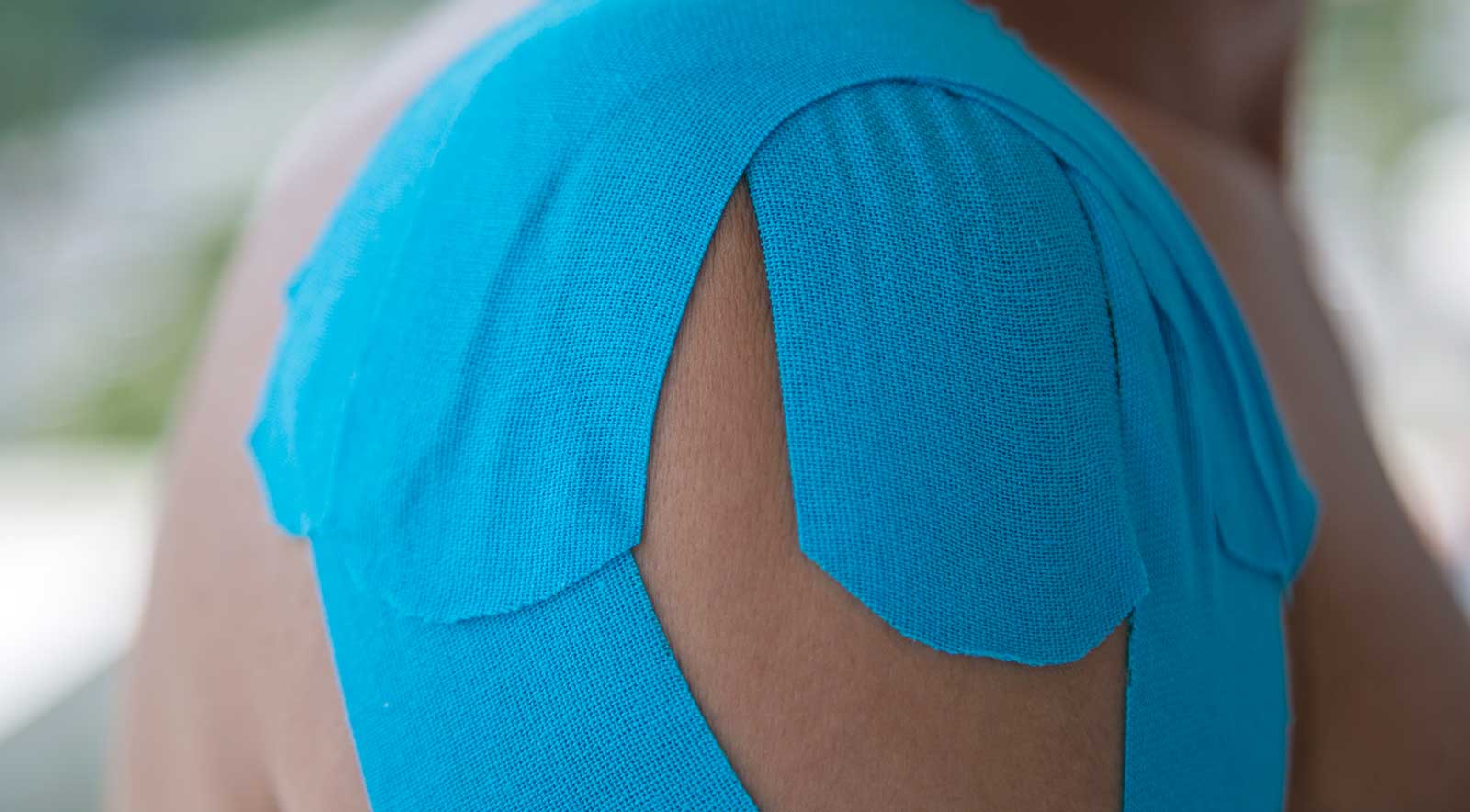 Separated Shoulder (AC Joint)