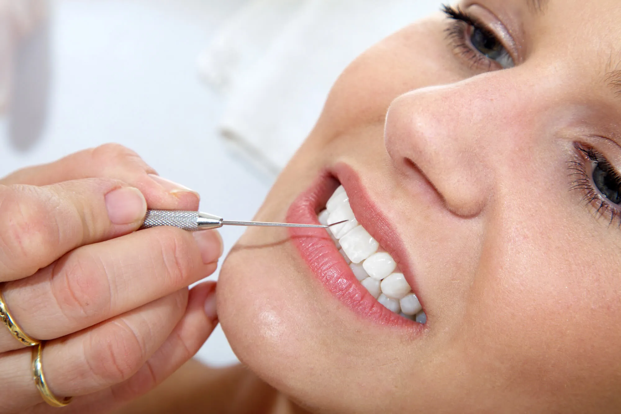 teeth cleaning boynton beach fl
