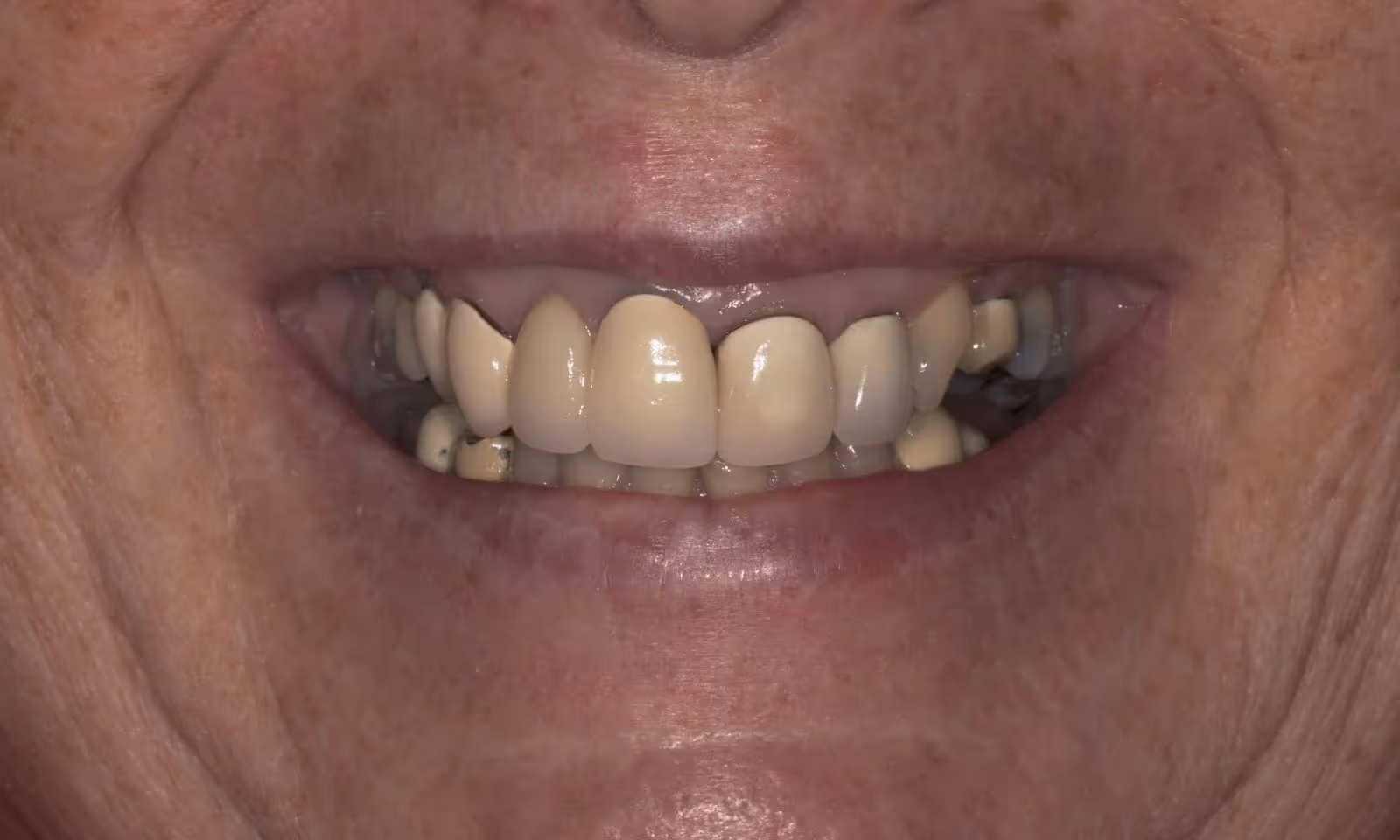 Before Image