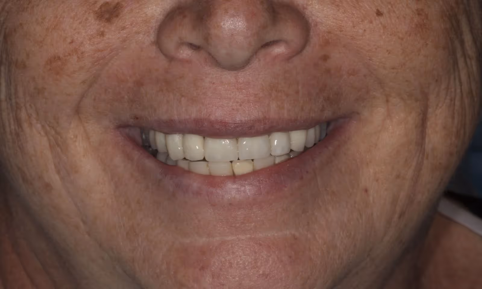 After Image