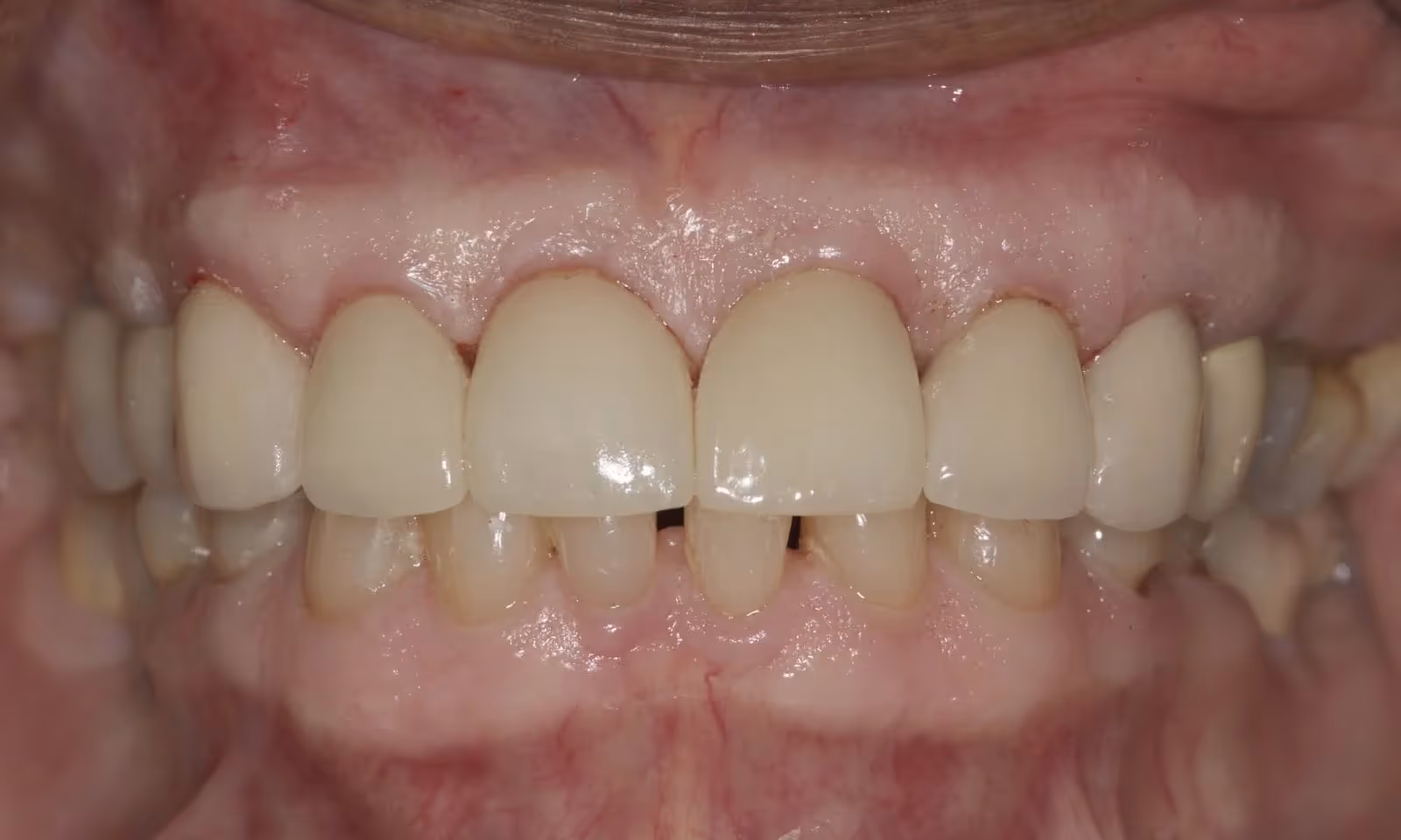 After Image
