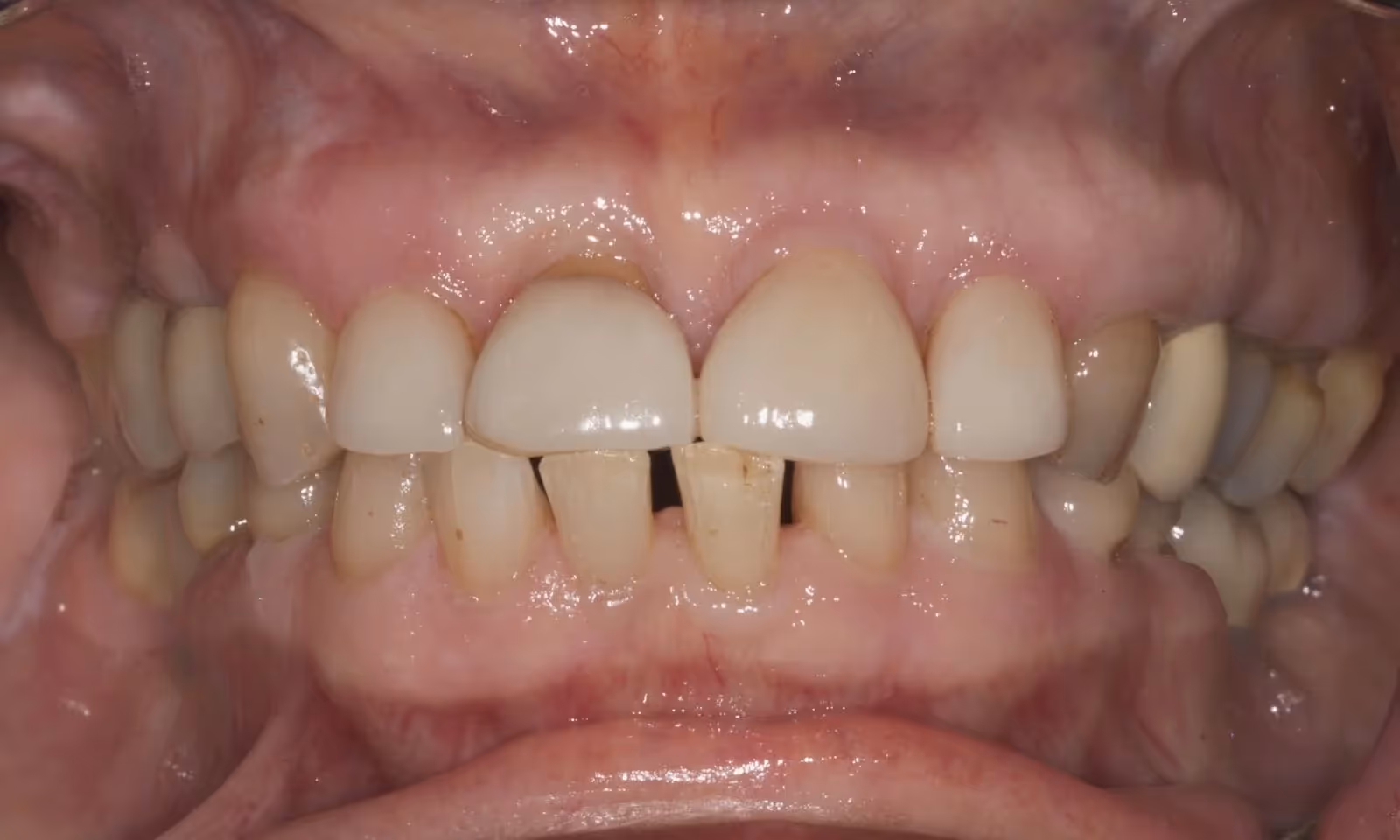 Before Image