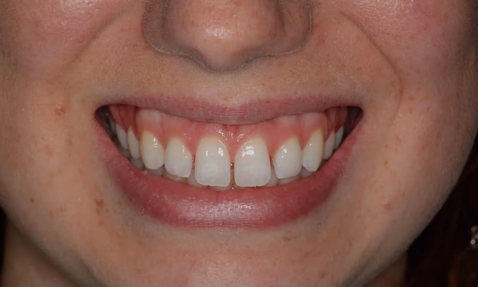 Before Image