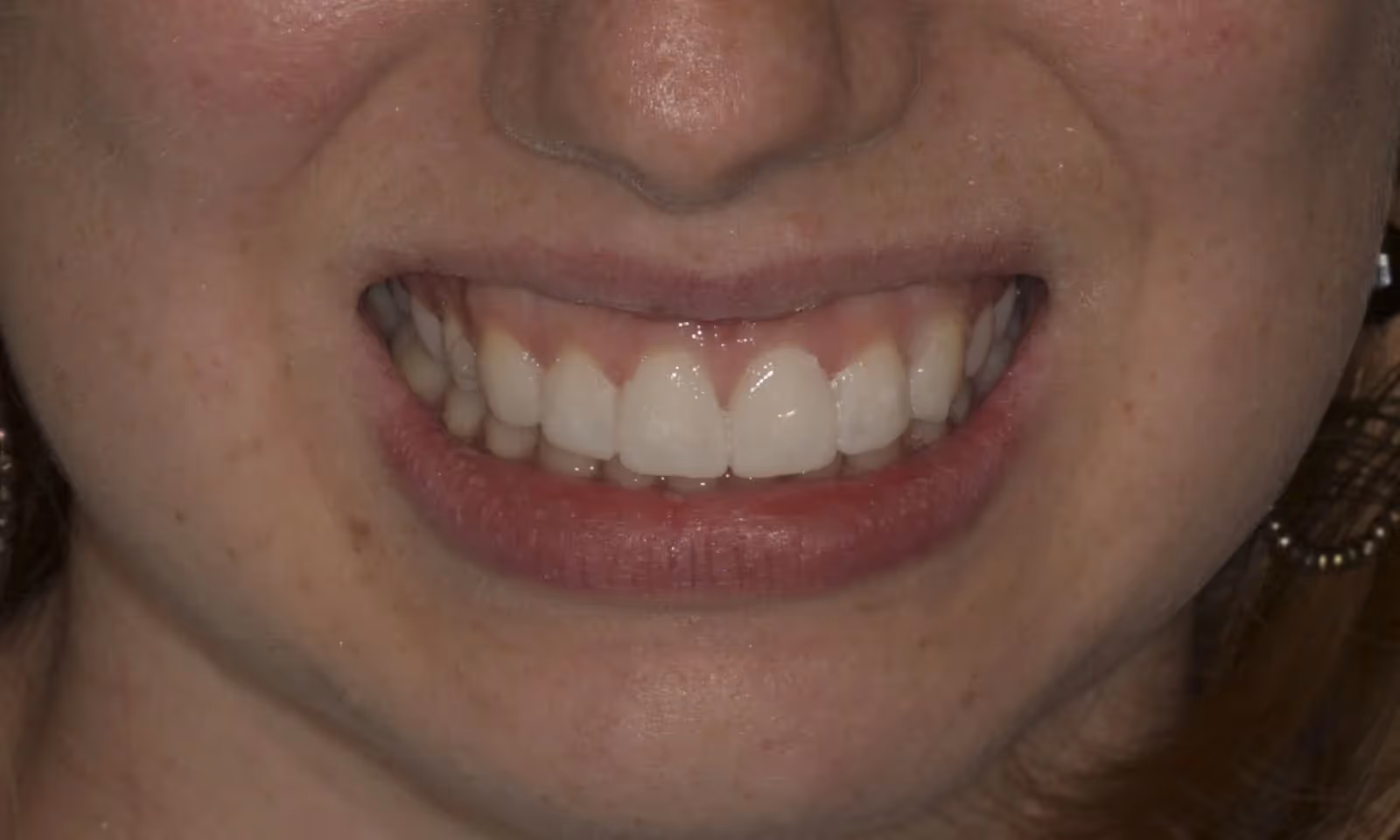 After Image