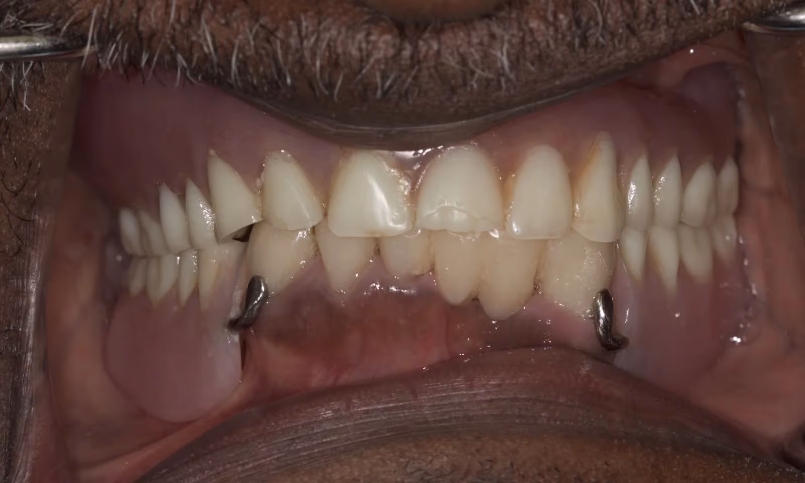 Before Image