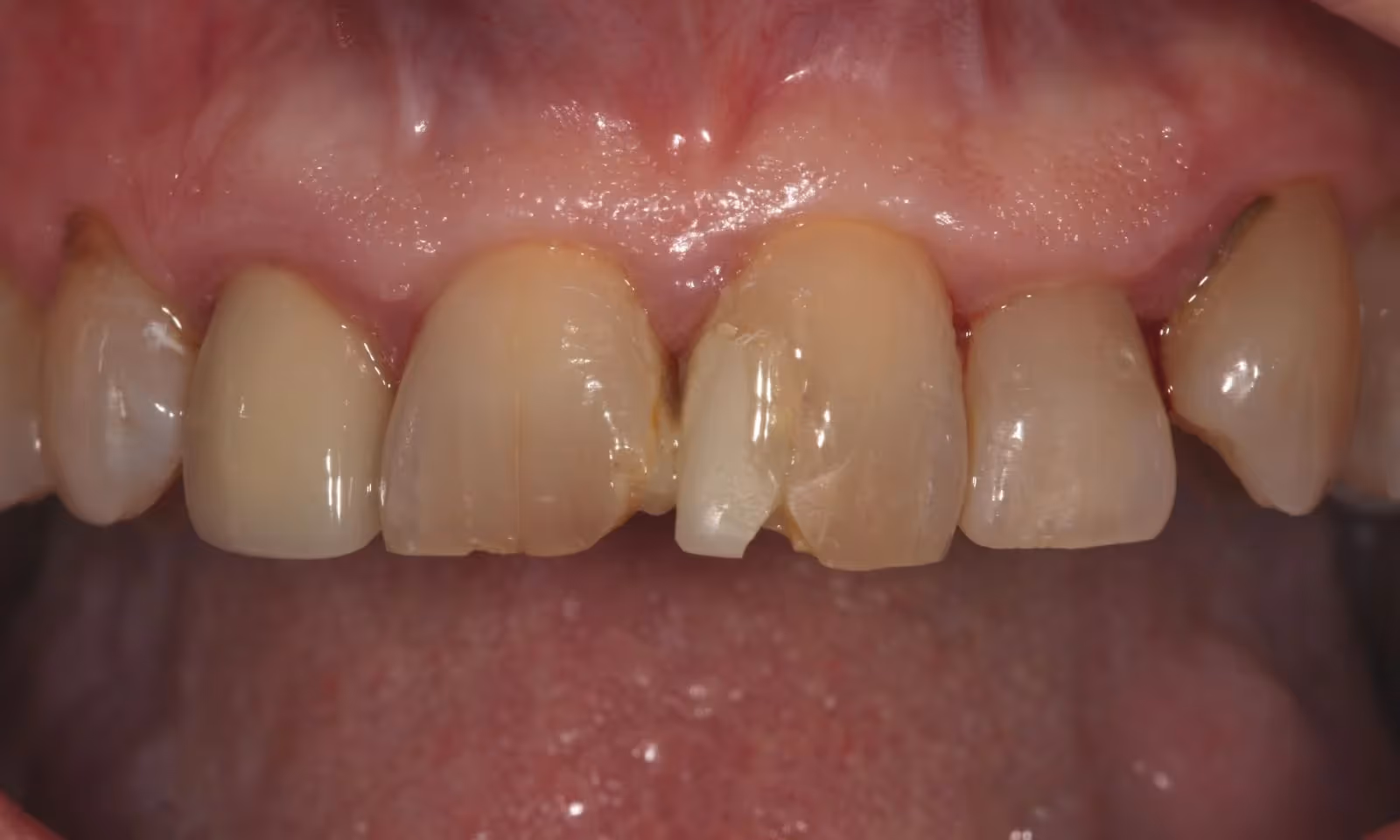 Before Image